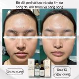  Tinh chất căng bóng sáng da-trẻ hoá LUMINA GLOW ACTIVATING PEEL hỗ trợ giảm thâm mụn, se lỗ chân lông 