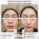  Tinh chất căng bóng sáng da-trẻ hoá LUMINA GLOW ACTIVATING PEEL hỗ trợ giảm thâm mụn, se lỗ chân lông 