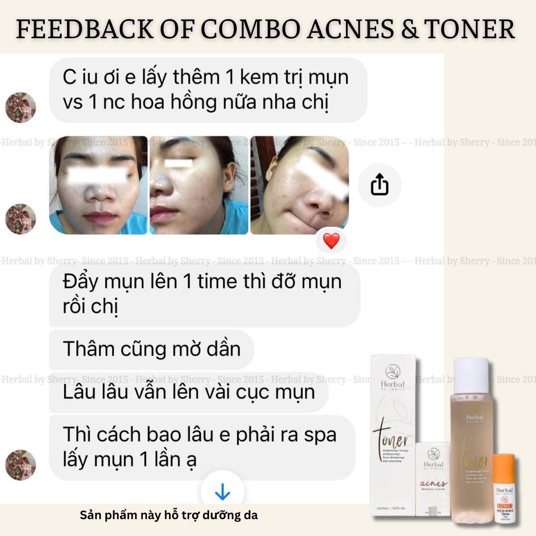  HERBAL TONER - Toner thảo dược 
