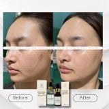  B57 COPPER PEPTIDE  SERUM- Serum đa Peptide cấp ẩm, chống lão hóa, phục hồi, làm dịu và hỗ trợ đầy sẹo 