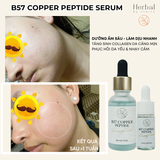  B57 COPPER PEPTIDE  SERUM- Serum đa Peptide cấp ẩm, chống lão hóa, phục hồi, làm dịu và hỗ trợ đầy sẹo 