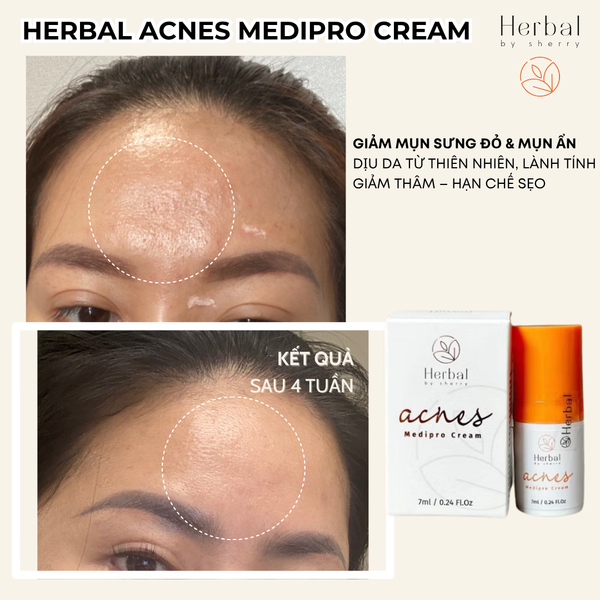  HERBAL ACNES MEDIPRO CREAM 