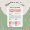 Kem dưỡng ẩm AOA Skin Rescue Balm