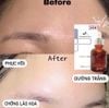 Serum GoodnDoc Hydra B5 30ml date T8 2024