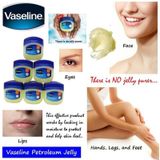  Sáp dưỡng ẩm Vaseline 49g (MP1803) 
