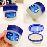  Sáp dưỡng ẩm Vaseline 49g (MP1803) 