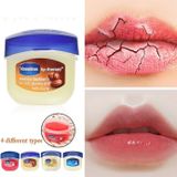  Sáp dưỡng môi Vaseline 7g (MP2859) 