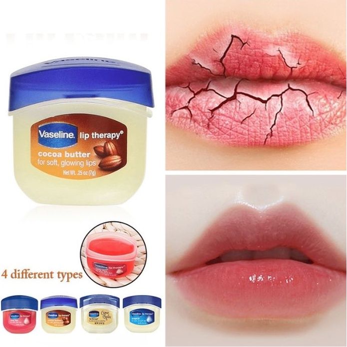  Sáp dưỡng môi Vaseline 7g (MP2859) 