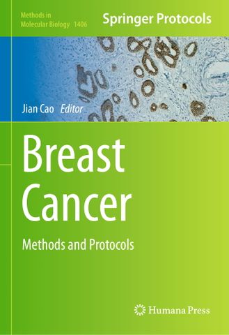 Breast Cancer Methods and Protocols