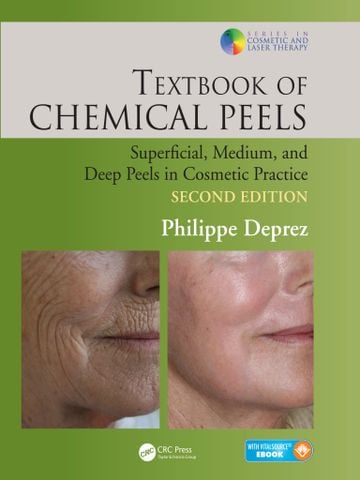 Textbook of chemical peels superficial, medium, and deep peels in cosmetic practice