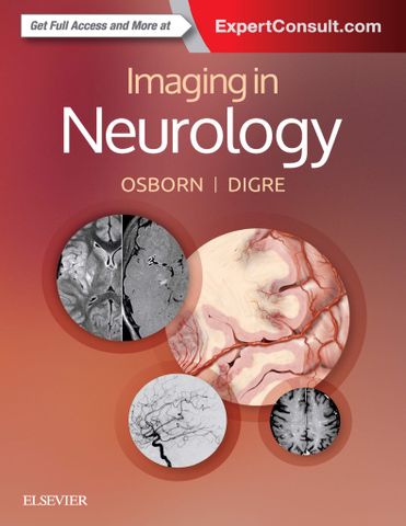 Imaging in Neurology 1st Edition
