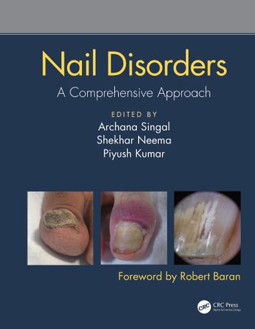 Nail Disorders: A Comprehensive Approach