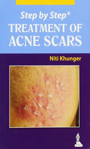 Treatment of Acne Scars