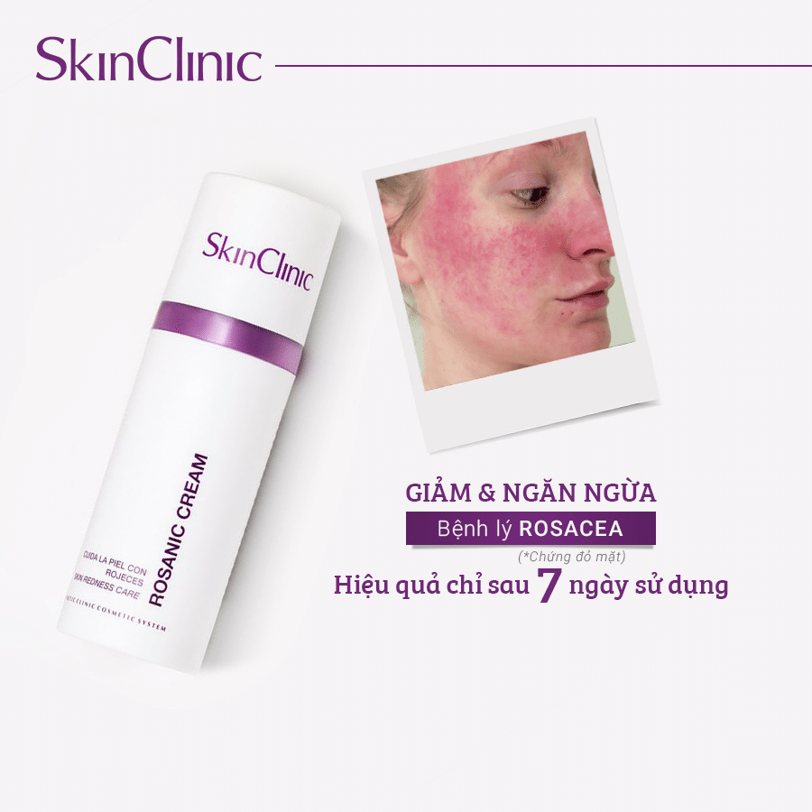 Skin clinic Rosanic Cream - Kem Dưỡng Chuyên Sâu Cho Tình Trạng Da Mẩn Đỏ, Da Nhạy Cảm