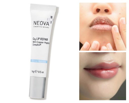 Neova Cu3 Lip Repair – Kem dưỡng ẩm, trị thâm & căng bóng môi