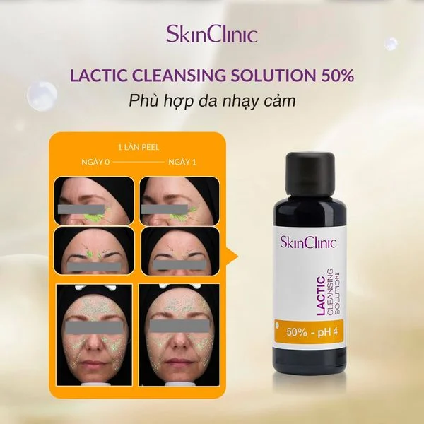 Skin clinic Lactic Cleansing Solution - Peel Dành Cho Da Nhạy Cảm
