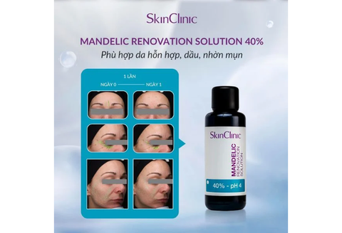 Skin clinic Mandelic Renovation Solution - Peel Dành Cho Da Hỗn Hợp, Da Dầu Mụn