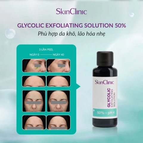 Skin clinic Glycolic Exfoliating Solution - Peel Dành Cho Da Khô, Lão Hóa Nhẹ