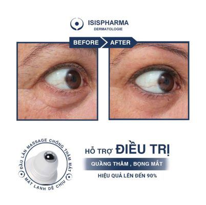 IsisPharma NEOTONE® eyes (Hỗ trợ điều trị quầng thâm, bọng mắt)