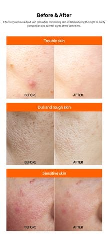 Peel Bí Đỏ +AHA +BHA Trẻ Hóa, Sáng Da 60g FAU Shiny Pumpkin Peel