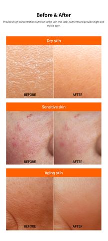 Serum Phục Hồi, Trẻ Hóa, Sáng Da FAU Shiny Pumpkin