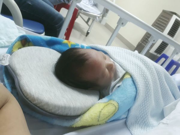 Gối chống bẹp đầu Babymoov