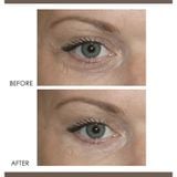  (BoxyCharm) Kem mắt cao cấp Dermelect giảm nhăn, giảm thâm quầng REVITALITE PROFESSIONAL Eyelid Dark Circle Corrector 