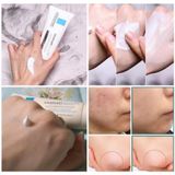  Kem Dưỡng Cicaplast Baume B5 Laroche-Posay 40ml 