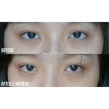  Serum dưỡng mắt Lancôme Adavanced Génifique Yeux Light Pearl 20ml Bản Tester 