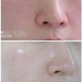  Kem dưỡng ẩm The Ordinary Natural Moisturizing Factors + HA 