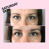  Kem Mắt Saturday Skin Yuzu Vitamin C Bright Eye Cream 15ml 32$ 