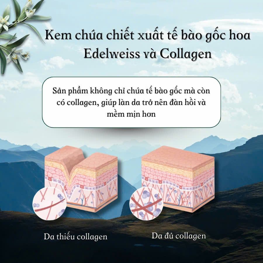  Kem tế bào gốc tái tạo tế bào da TBG01 