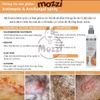 Xịt giảm ngứa nấm Antiseptic & Antifungal Spray chai 237ml