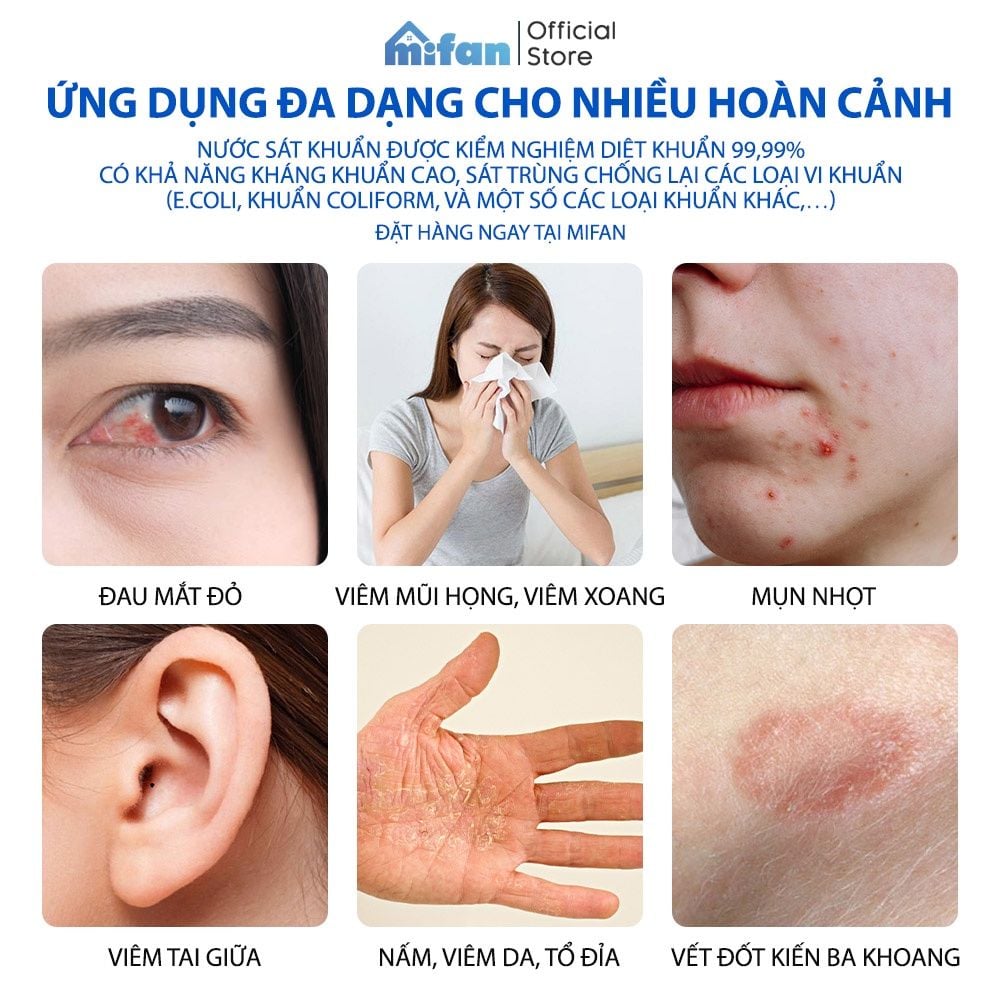 Dung dịch sát khuẩn Smart A 500ml