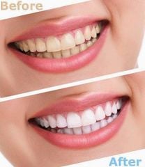 Kem Đánh Răng Crest 3D White Ultra 3in1 Benefits Vivid Mint 147gr