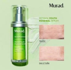 Tinh Chất Hỗ Trợ Tái Tạo, Trẻ Hóa Da Murad Retinol Youth Renewal Serum 5ml