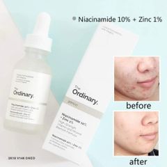 Tinh chất dưỡng The Ordinary Niacinamide 10% + Zinc 1% 30ml