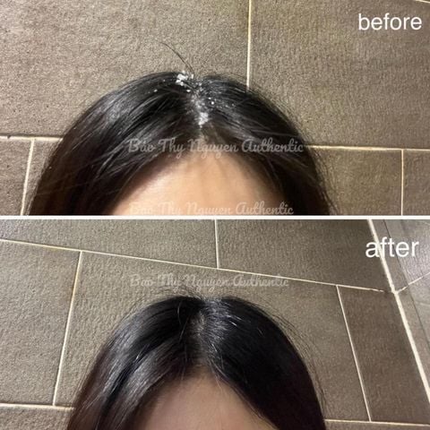 Xịt dưỡng mọc tóc và tẩy da chết da đầu Aromatica Rosemary Sclap Scrub & Aromatica Rosemary Root Enhancer (đủ bill)