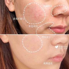 Tinh chất dưỡng sáng da, mờ thâm nám serum KIEHL'S Clearly Corrective Dark Spot Solution 15ml - PHỒNG PHỀNH