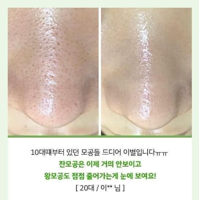 Tinh chất cà chua xanh & Nho tím Sungboon Editor Green Tomato Pore Lifting Ampoule+ se lỗ chân lông - PHỒNG PHỀNH