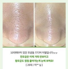 Tinh chất cà chua xanh & Nho tím Sungboon Editor Green Tomato Pore Lifting Ampoule+ se lỗ chân lông - PHỒNG PHỀNH