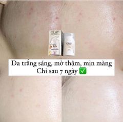 [Có Bill UK] Sẵn Mẫu mới Set Olay Kem chống lão hoá UK- kem dưỡng ngày đêm Olay Total Effects Anti-Ageing 7in1