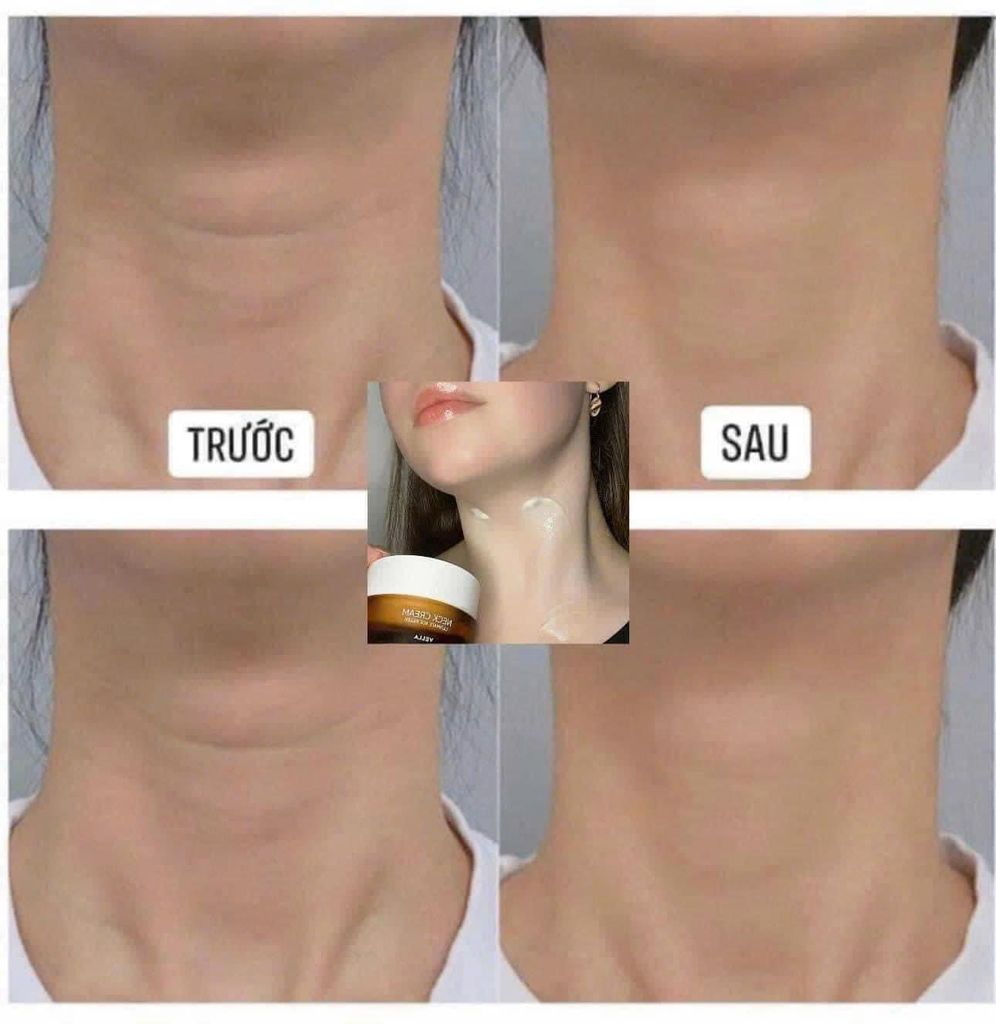 KEM DƯỠNG DA CỔ VELLA NECK CREAM- ULTIMATTE AGE KILLER 50ML (MẪU MỚI)