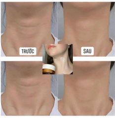 KEM DƯỠNG DA CỔ VELLA NECK CREAM- ULTIMATTE AGE KILLER 50ML (MẪU MỚI)