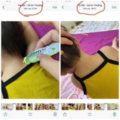 Kem Bôi Đa Năng Baifem K - Gel Dưỡng Ẩm Hoàng Cầm, Bảo vệ, Dịu Nhe, Da Cơ Địa, Chàm Sữa, Mẩn Ngứa (Tuýp 40g)