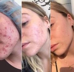 [Minisize]BỘT CÁM GẠO TẨY DA CHẾT TÁI TẠO, SÁNG DA DERMALOGICA DAILY MICROFOLIANT 4gr