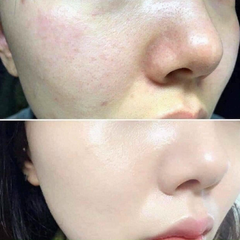 Kem Dưỡng Obagi Clinical Kinetin+ Hydrating Cream 50ml (DATE 1/26)