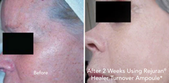 Serum REJURAN Turnover Ampoule 10ml c-PDRN Anti-Aging