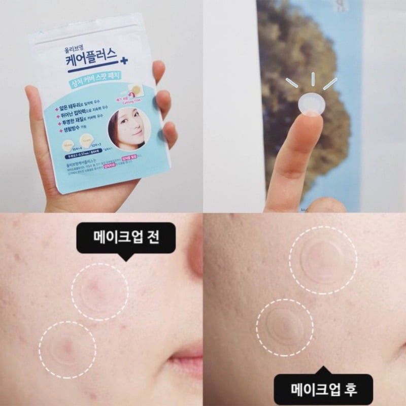 Miếng Dán Mụn Olive Young Care PlusScar Cover Spot Patch