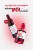 Tinh chất peel da SONATURAL Red Peel Tingle Serum 35ml